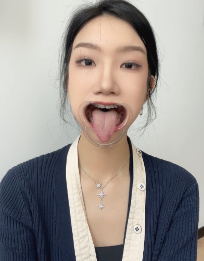 恋物癖口腔舌头喉咙视频系列:永久有效,双层压缩